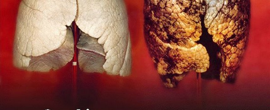 РЗИ Пазарджик приканва 19 ноември да бъде Ден без тютюнев дим