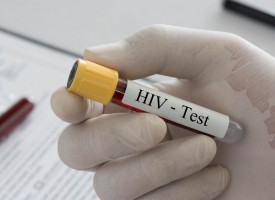 Седмица за безплатно и анонимно изследване за ХИВ в РЗИ Пазарджик