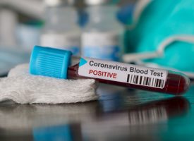 35 нови с коронавирус са диагностицирани в събота